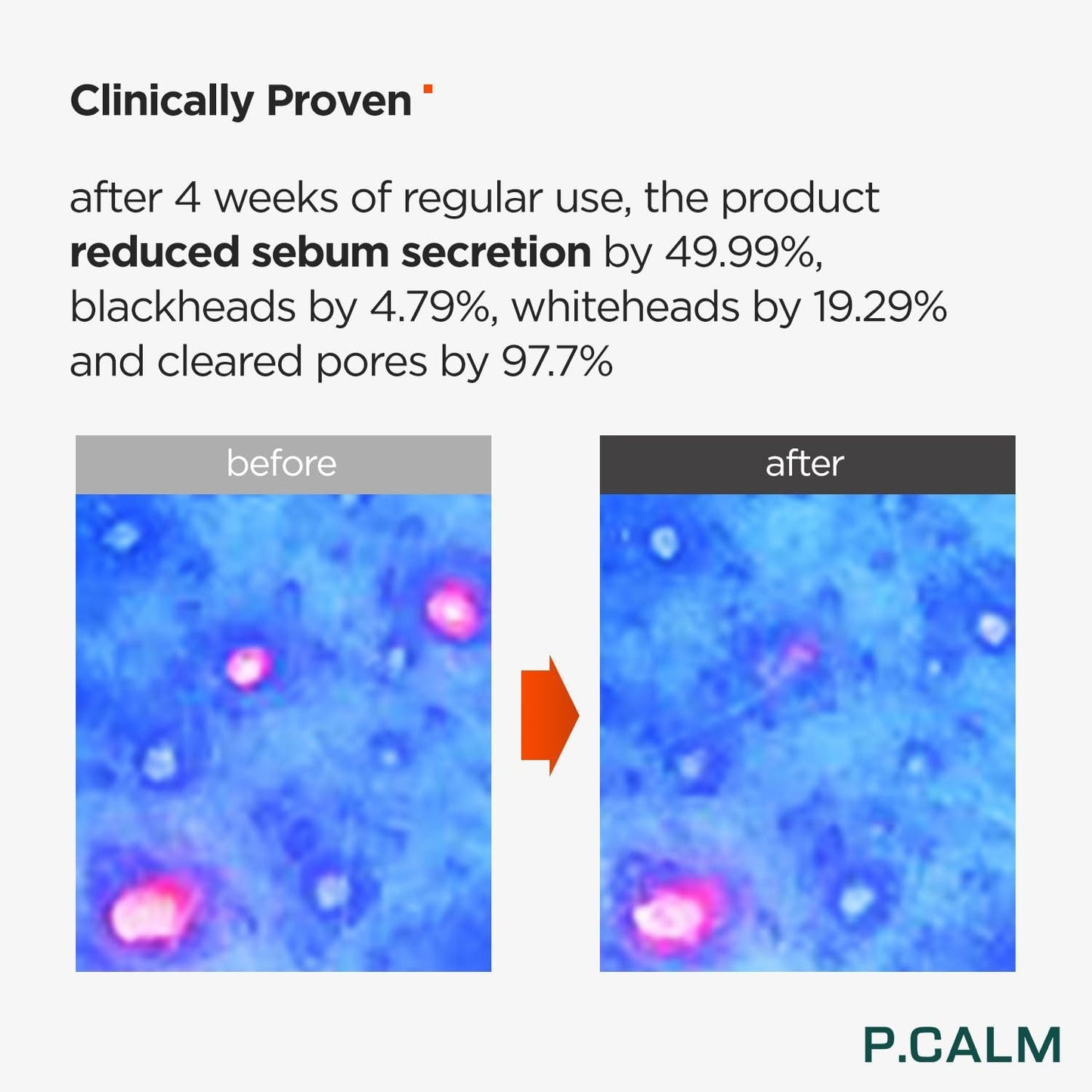 Underpore Foam Cleanser