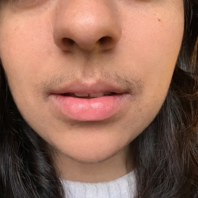 Before